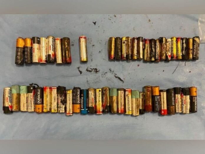 woman-swallow-55-batteries