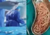 बच्ची के पेट में सैकड़ों कीड़े देख डॉक्टर भी रह गए हैरान, सर्जरी से बची जान, पेरेंट्स को चेतावनी