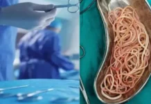 बच्ची के पेट में सैकड़ों कीड़े देख डॉक्टर भी रह गए हैरान, सर्जरी से बची जान, पेरेंट्स को चेतावनी