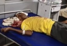 ट्रैक्टर रोड किनारे पेड़ से टकराया- ट्राली से गिरने से एक व्यक्ति घायल