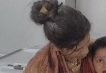 आंगन में खेल रही 2 वर्षीय मासूम पर लावारिस कुत्ते ने किया हमला