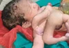 छतरपुर में कुदरत का अद्भुत नजारा… 4 हाथ और 4 पैर वाले बच्चे का जन्म, देखने के लिए उमड़ी भीड़