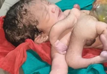 छतरपुर में कुदरत का अद्भुत नजारा… 4 हाथ और 4 पैर वाले बच्चे का जन्म, देखने के लिए उमड़ी भीड़
