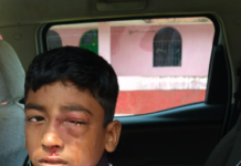 3 मोटरसाइकिल के बीच हुई सीधी भिड़ंत,हादसे में 6 घायल, एक की हालत गम्भीर