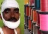 बाइक सवार के चेहरे पर लिपटा चाइनीज मांझा, पलभर में उड़ गया पूरा जबड़ा, जान बचाने डॉक्टरों ने लगाने पड़े 22 टांके