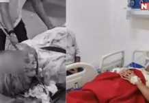 आंख के पास से घुसा, कान के पीछे निकला 3.5 फीट का सरिया! रतलाम के डॉक्टरों ने रिस्क लेकर बचाई जान, बोले- ‘21 साल में पहला केस’