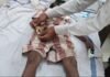 सर्पदंश से बैगा परिवार का बुझा घर का चिराग