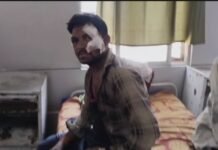तेज रफ्तार कार ने मोटरसाइकिल को मारी टक्कर: तीन युवक घायल